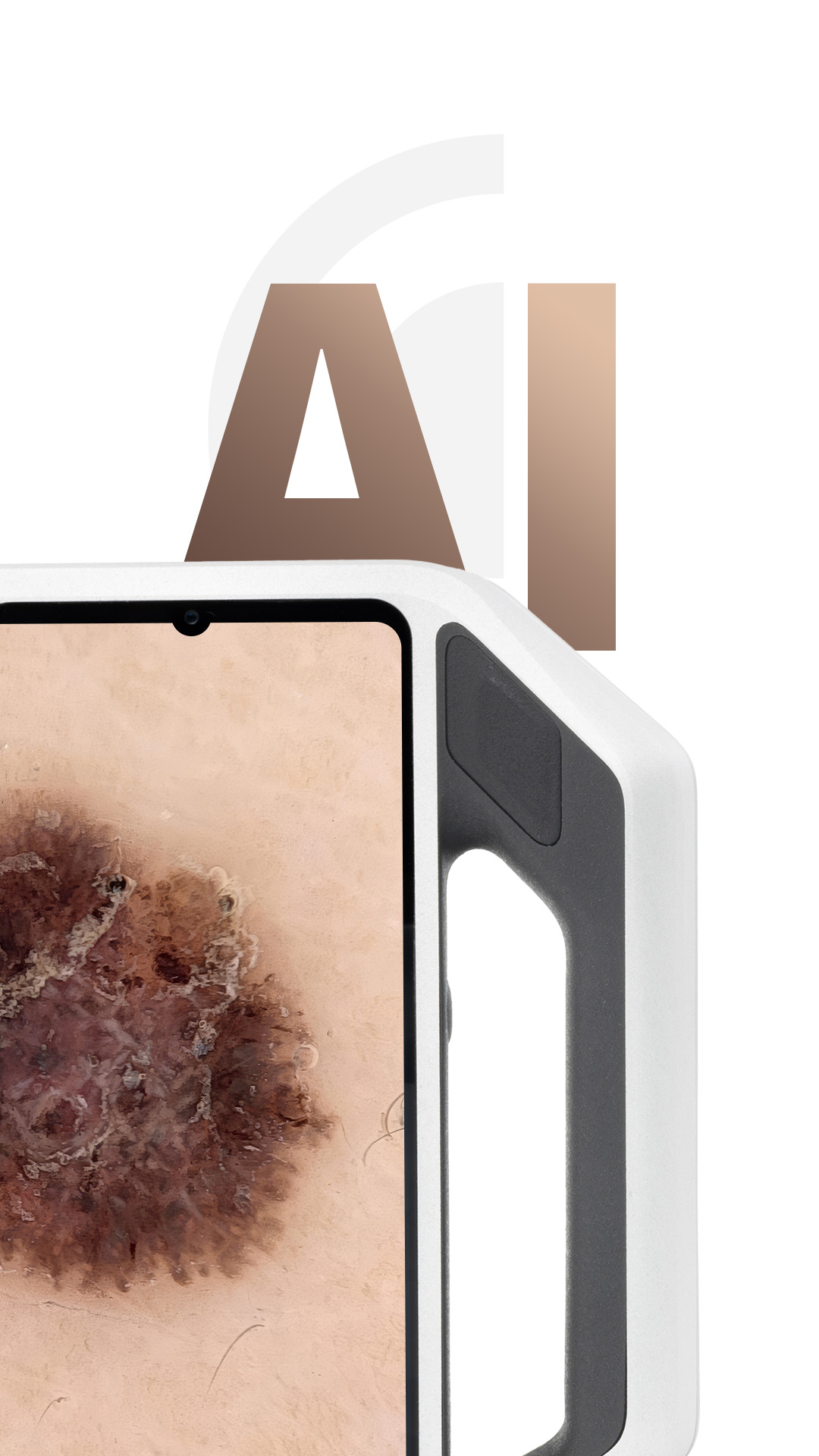 Visualization of the AI Cloud with smartphone and dermoscopic image of a skin lesion.