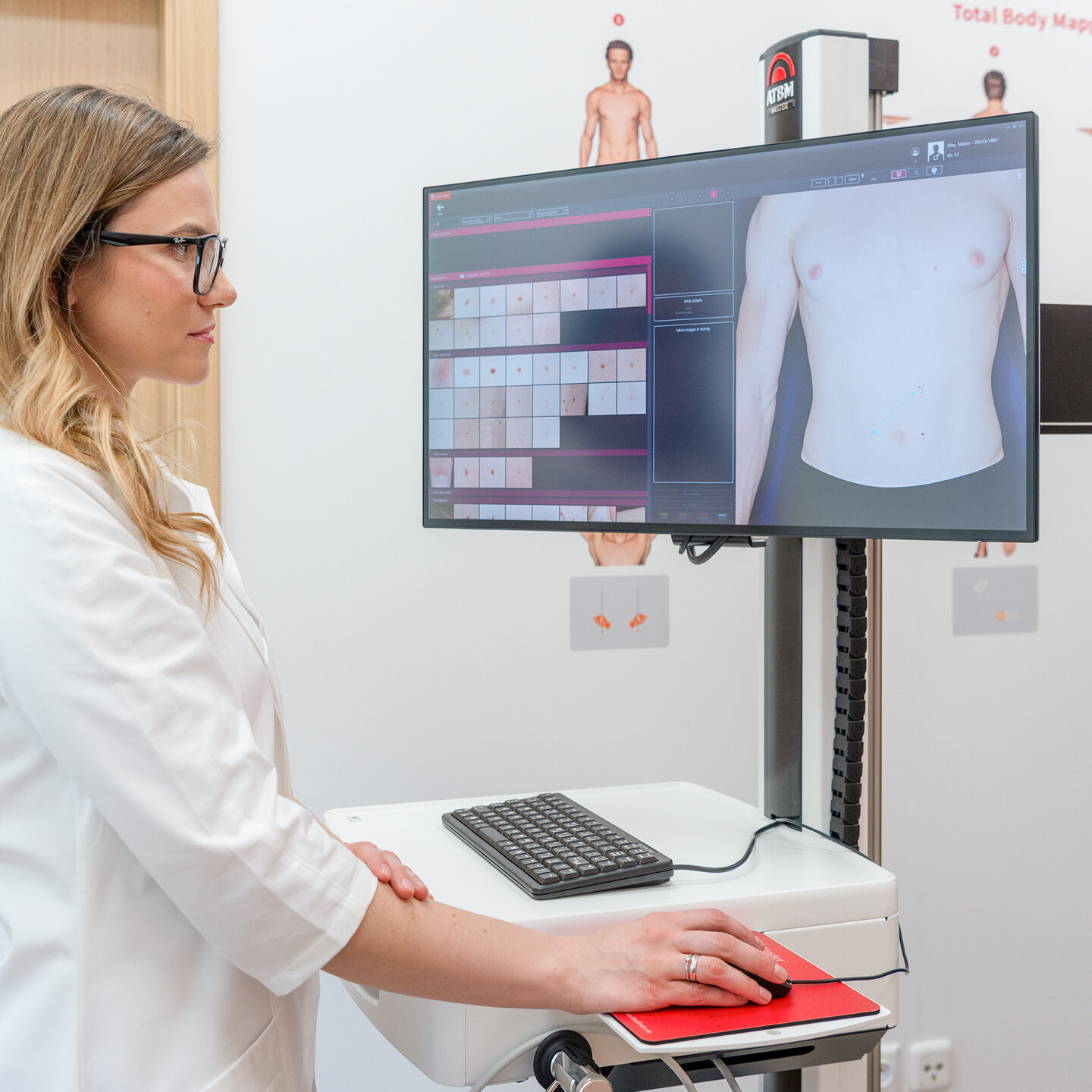 Ärztin arbeitet mit dem FotoFinder ATBM master zur Hautkrebsvorsorge