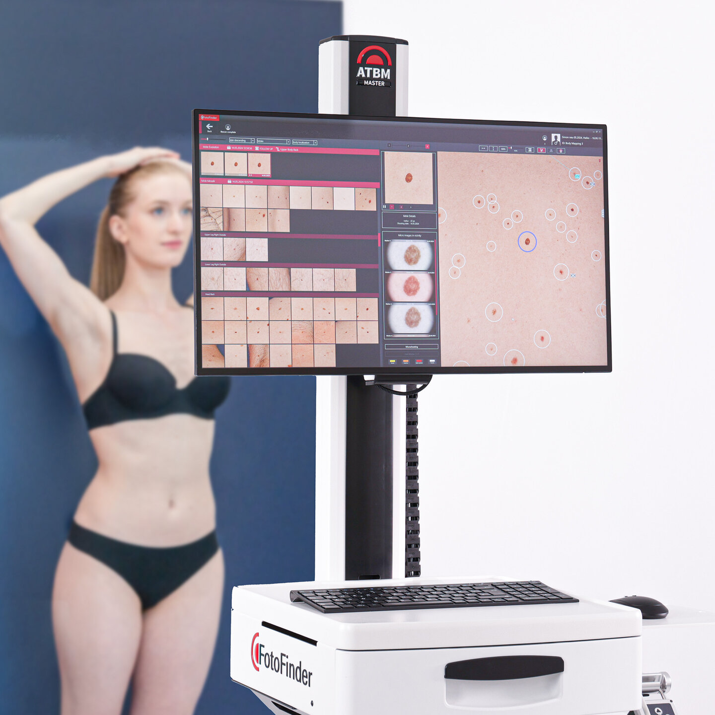 Effiziente Hautbildgebung mit dem FotoFinder ATBM master