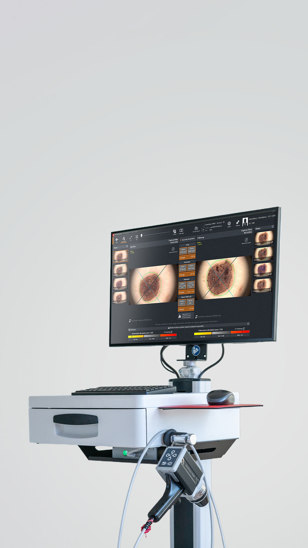 FotoFinder vexia mit Bildschirmansicht mehrerer Hautläsionen