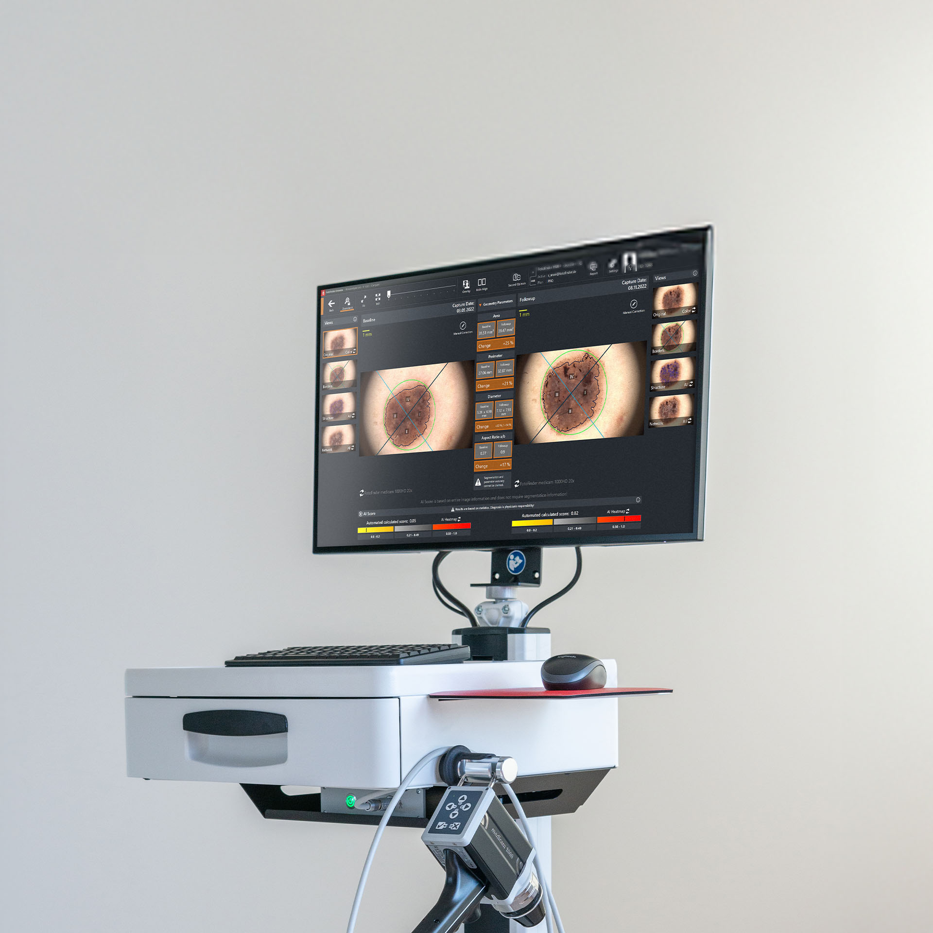 Schräg aufgenommene Nahaufnahme des oberen Bereichs vom FotoFinder vexia Bildschirm mit Auswertungsdaten