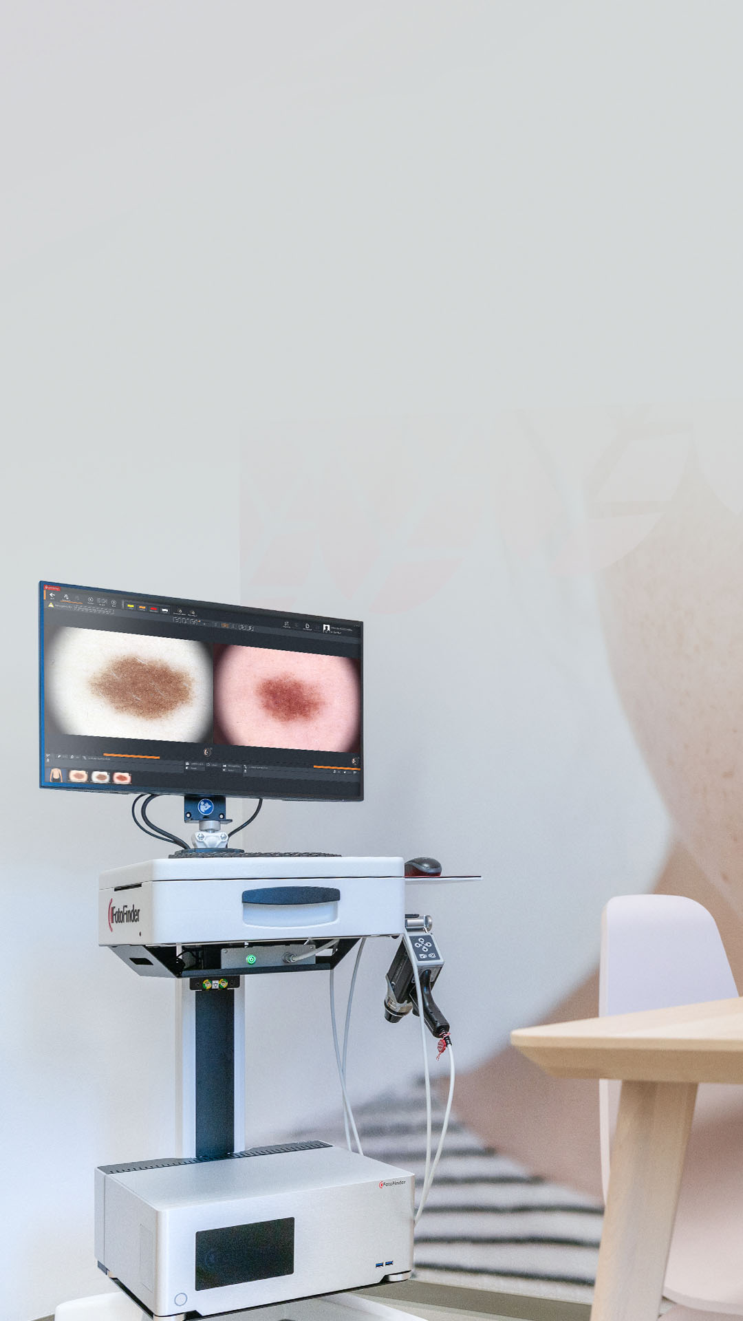 FotoFinder vexia mit Monitoransicht zur Verlaufskontrolle von Hautläsionen