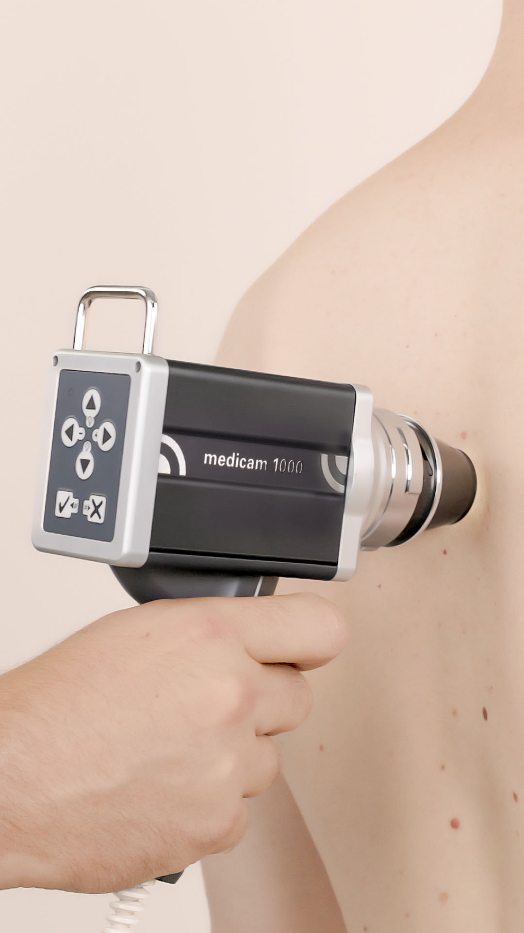 Hautuntersuchung mit einem mobilen FotoFinder medicam Dermatoskop