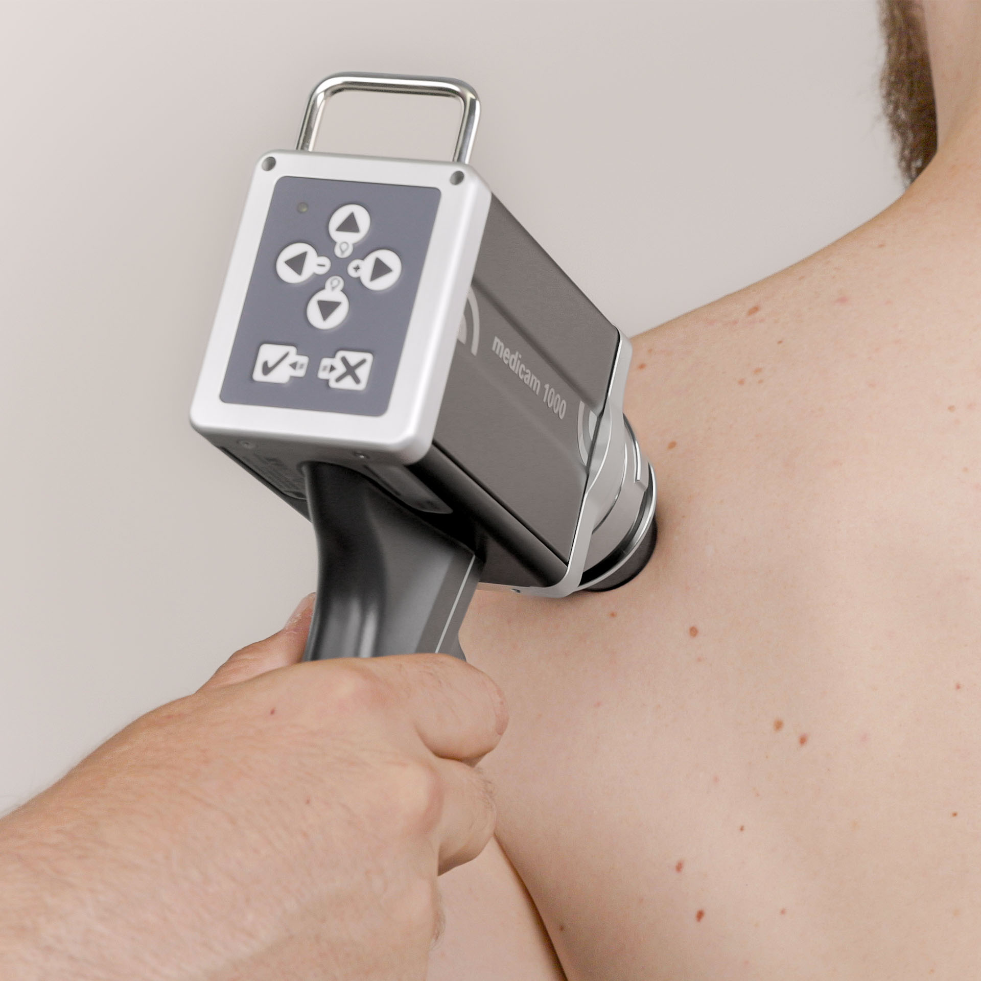 Nahaufnahme einer Hautuntersuchung mit der integrierten medicam Kamera