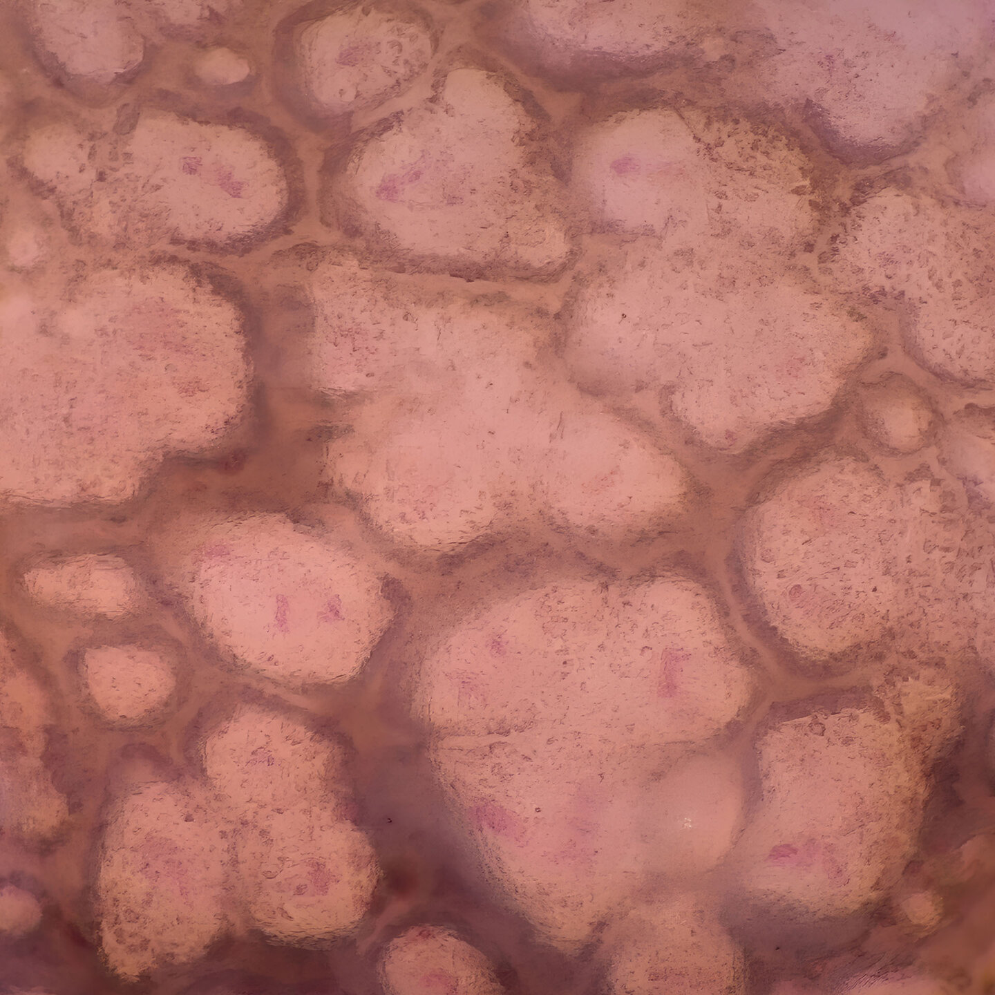 Dermatoskopische Aufnahme von Hautstrukturen mit 400-facher Vergrößerung