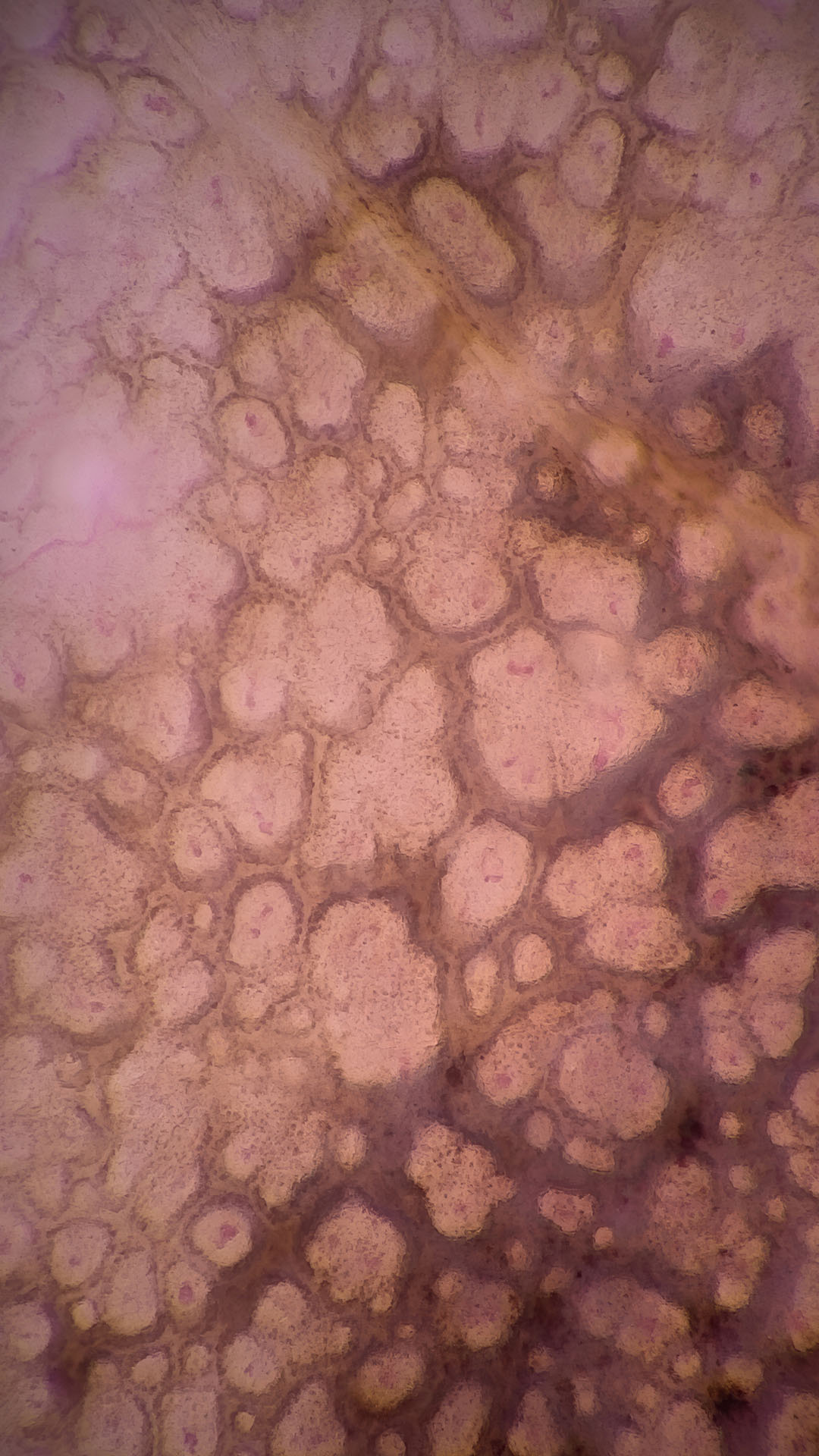 Dermatoskopisches Hautbild mit Super-High Magnification