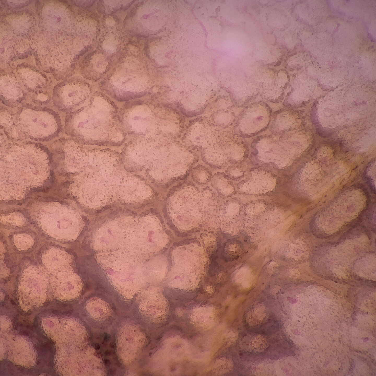 Hautstruktur unter Super-High Magnification mit dem FotoFinder medicam