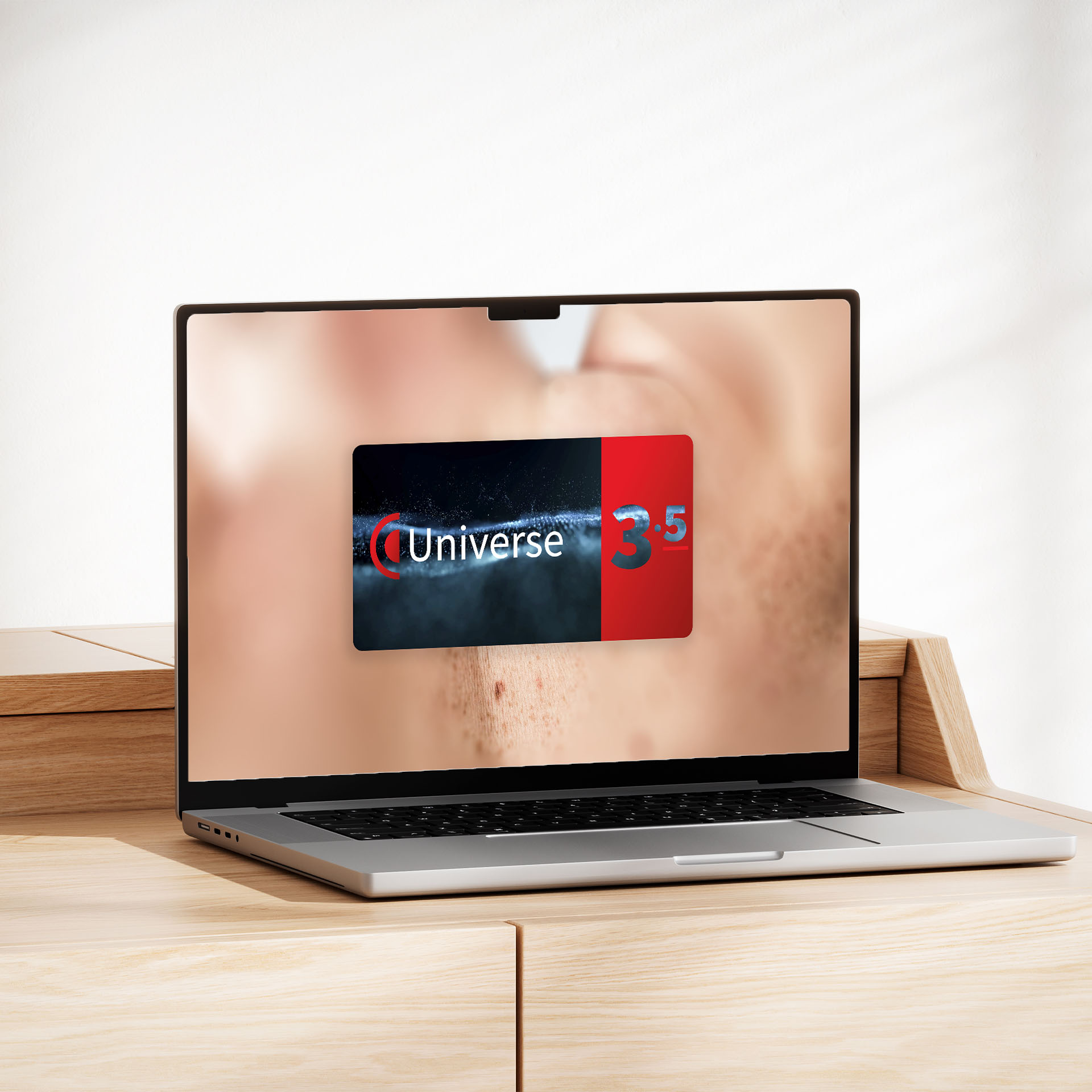 medicam Bildaufnahme auf einem Monitor mit Universe-Logo