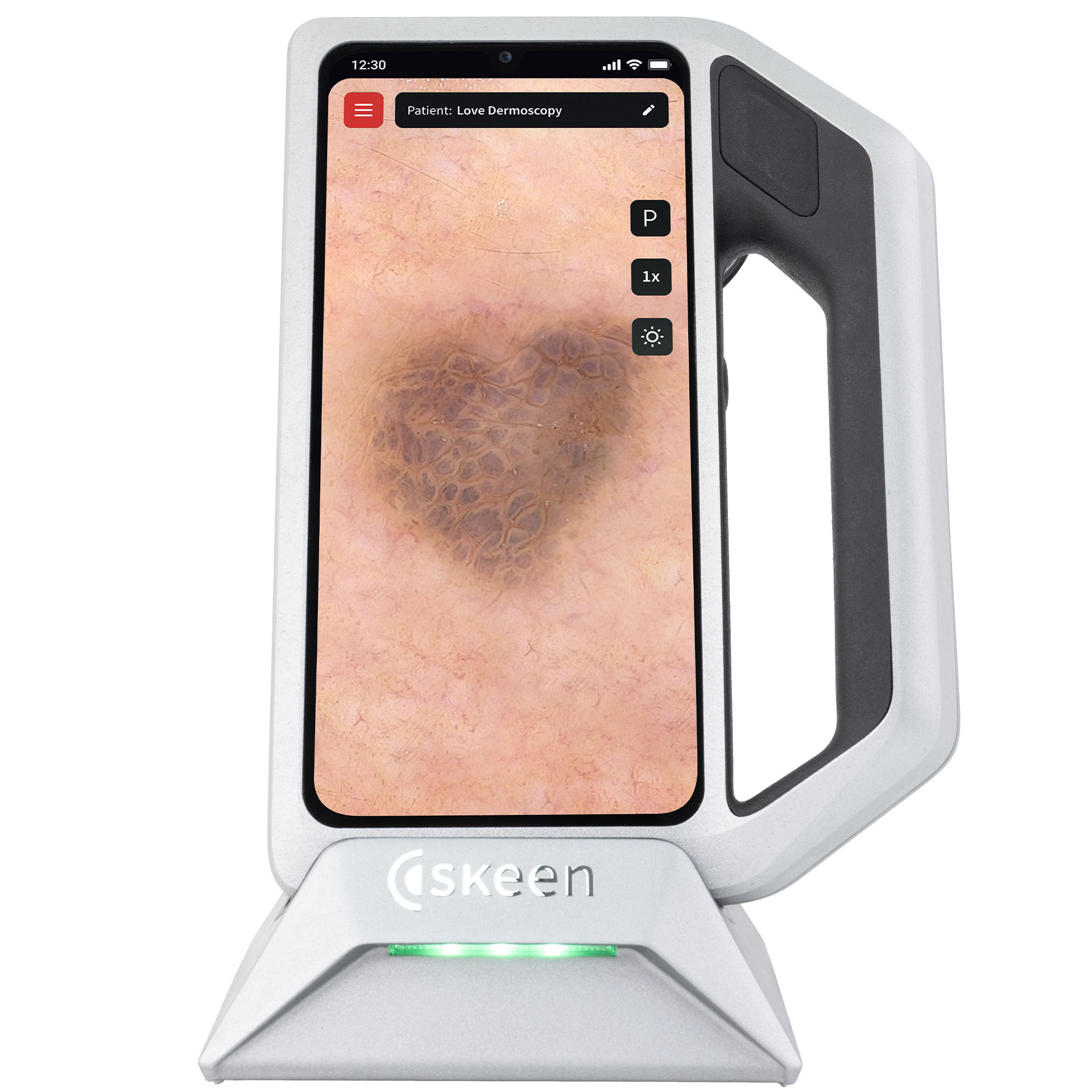 skeen mit angezeigter dermatoskopischer Aufnahme auf dem Touchscreen