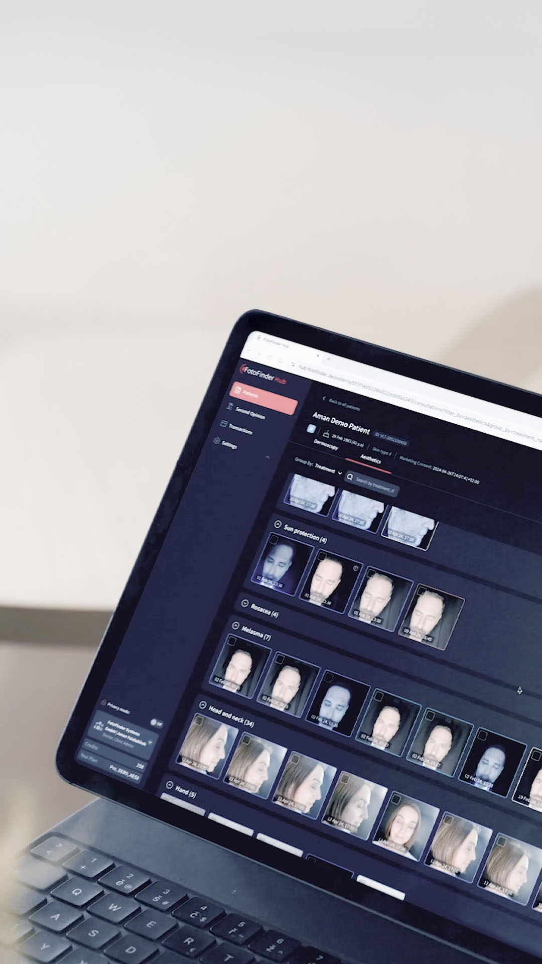 Verwaltung einer Trichoskopie-Aufnahme in der skeen App