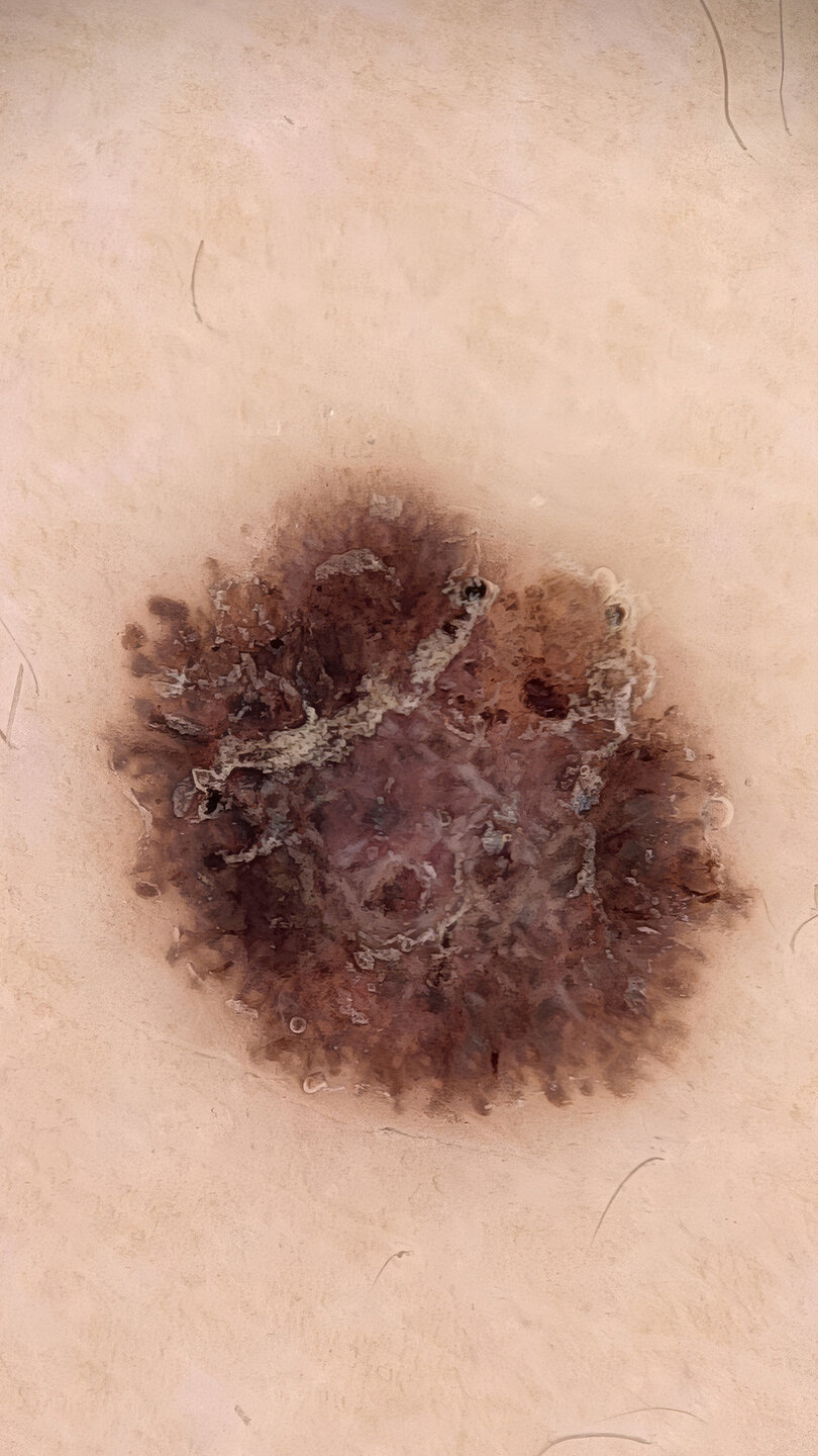 Detailansicht des skeen mit 40-fachem Zoomobjektiv