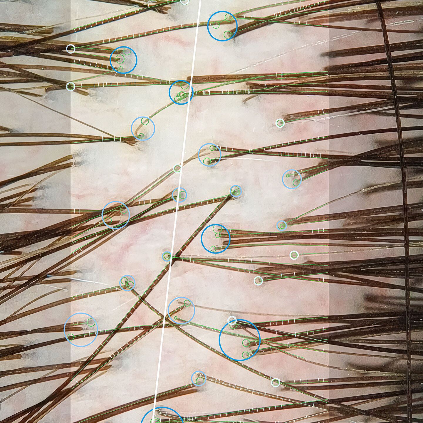 Trichoscopic image of hair and scalp taken with skeen