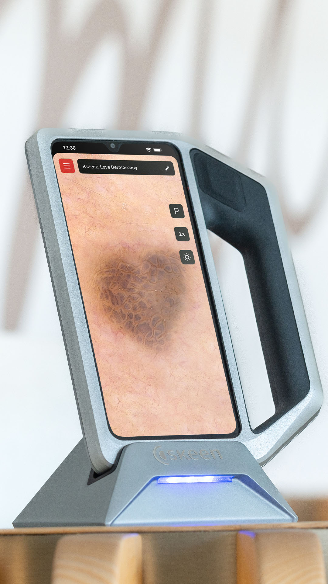 Dermatoskopische Aufnahme in Herz-Form auf dem skeen Bildschirm