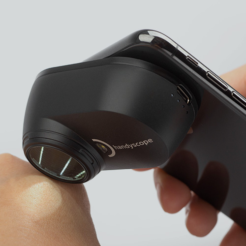 Examination with the handyscope