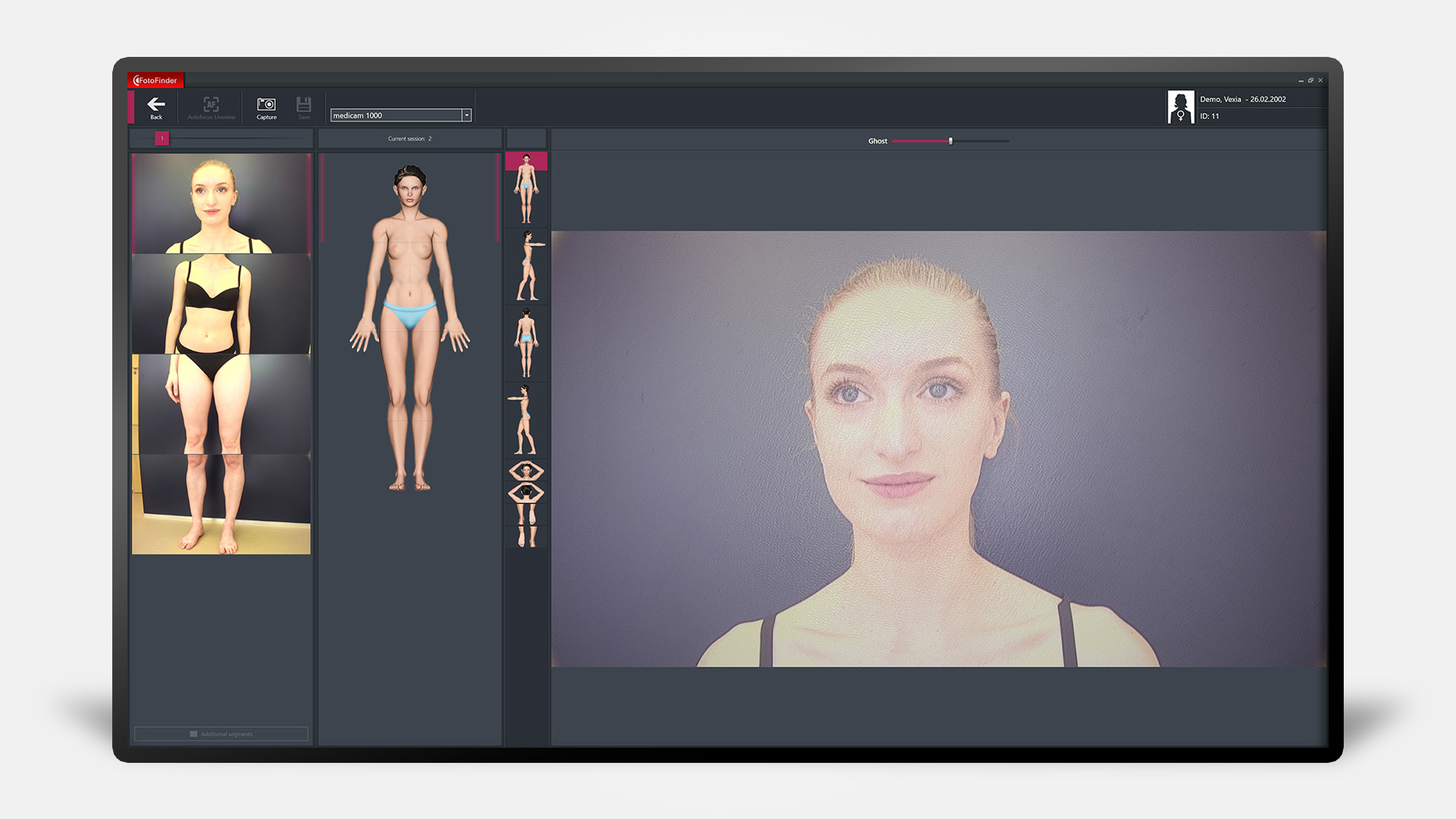 Bildschirm mit Total Boy Mapping und Patientin