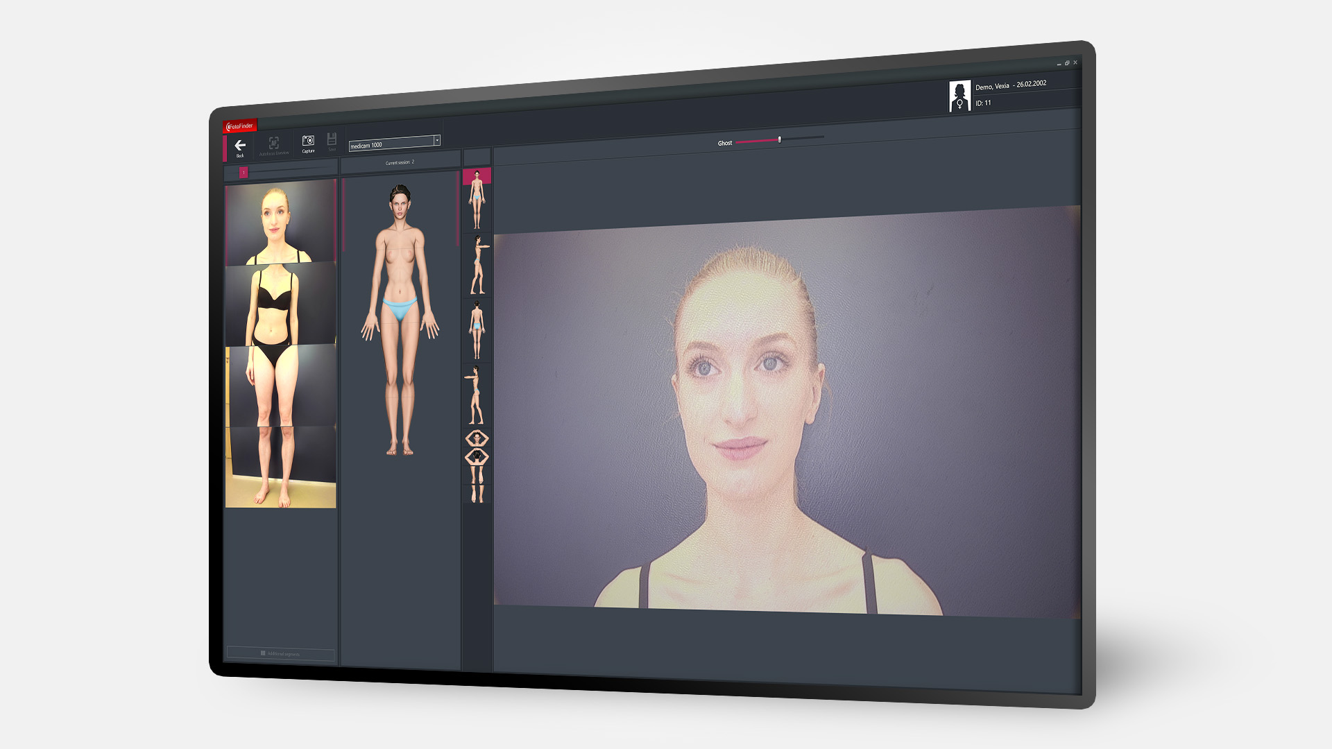 Bildschirm mit Total Boy Mapping und Patientin