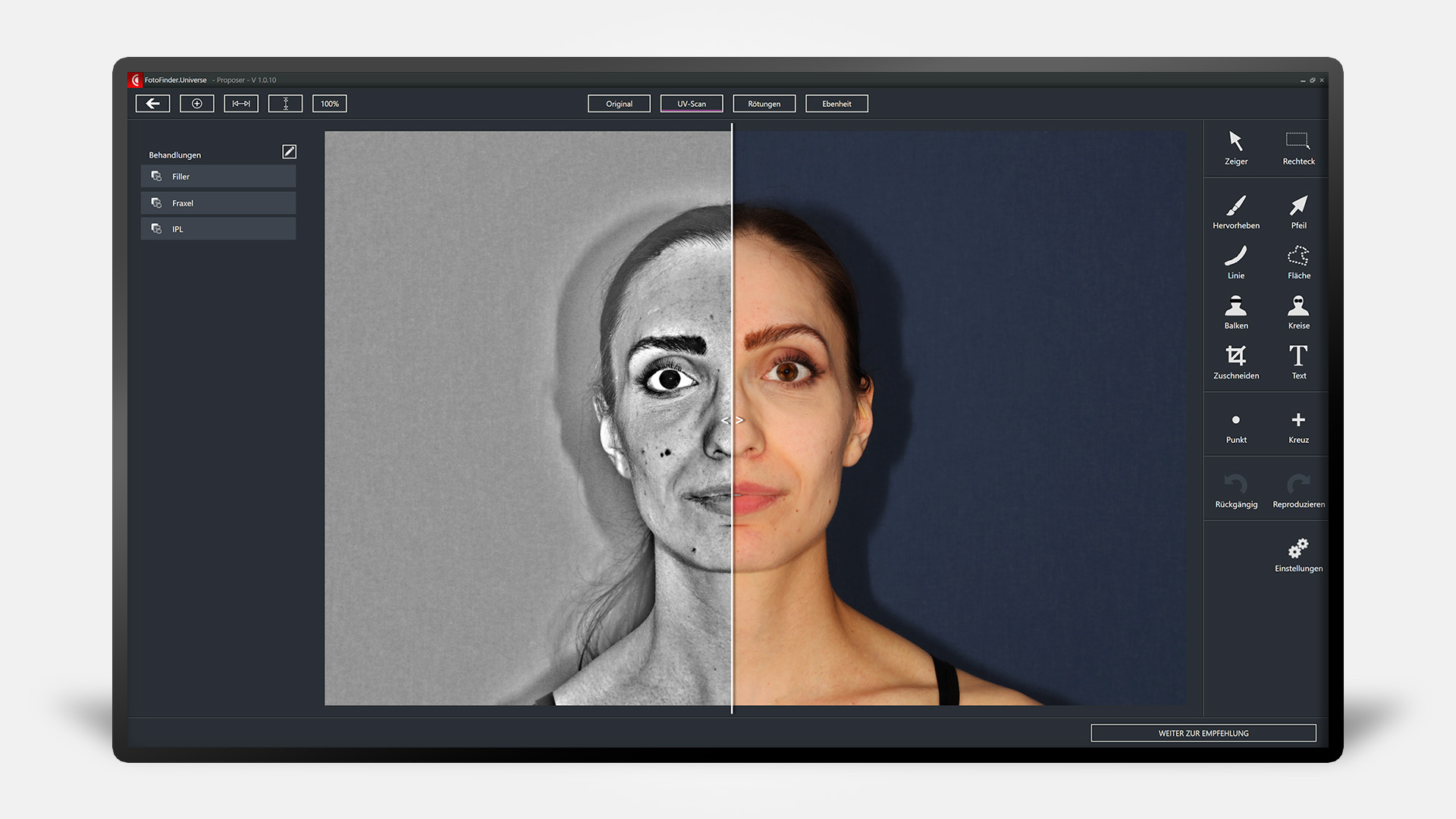 Bildschirm mit FotoFinder Proposer