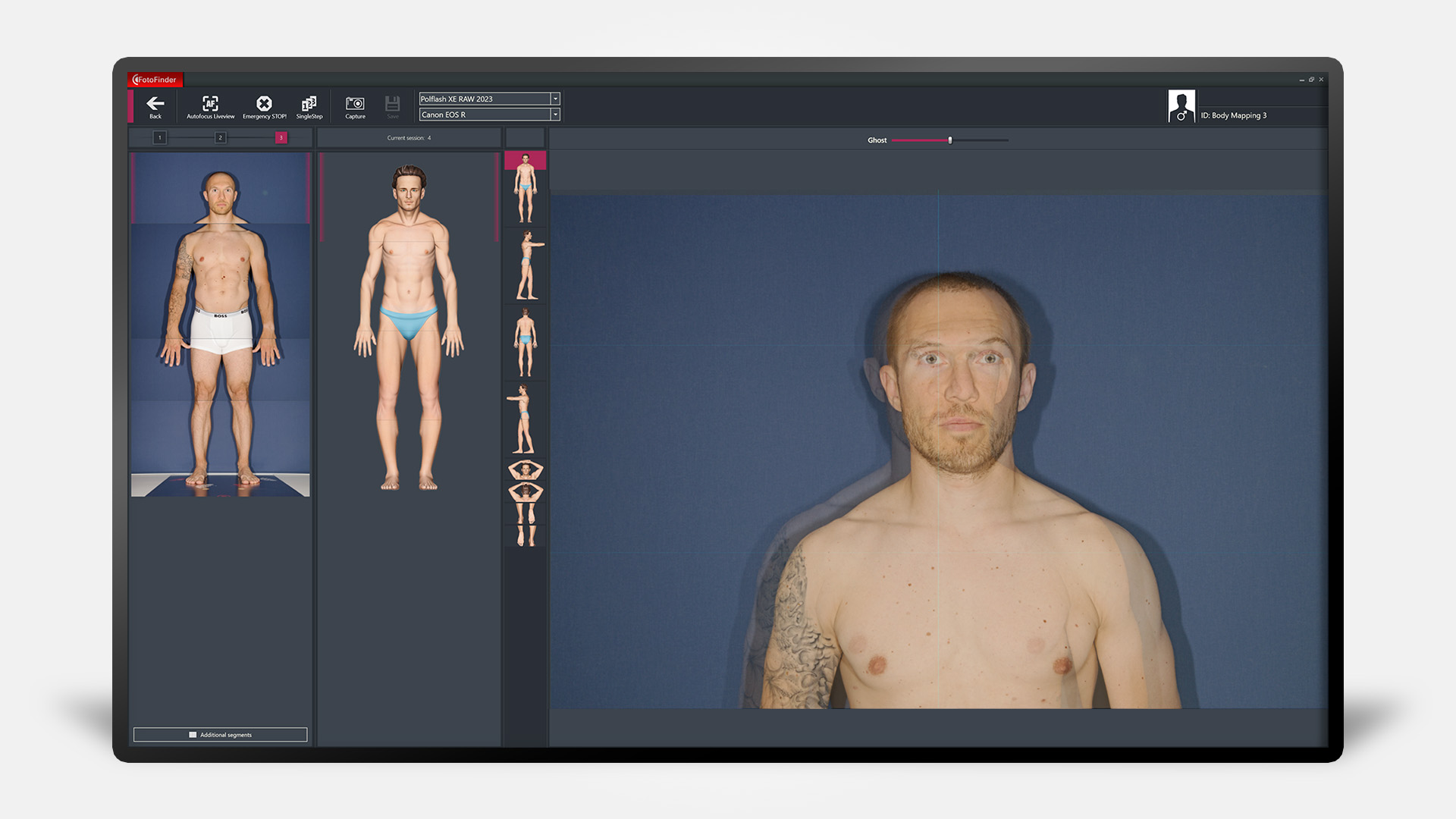 Bildschirm mit Total Body Mapping