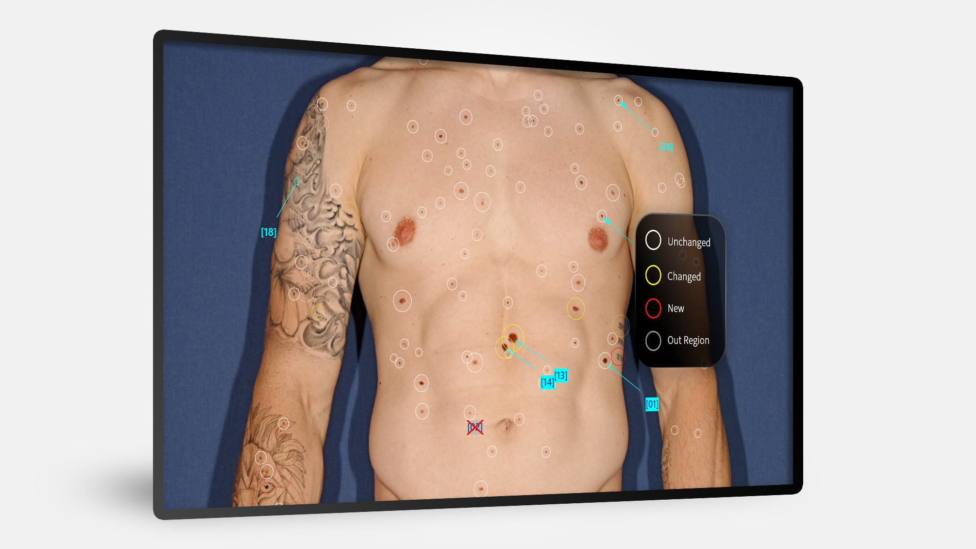 Bildschirm mit BodyScan