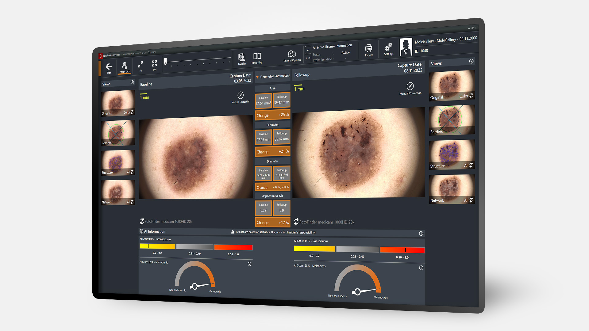 Bildschirm mit Moleanalyzer pro