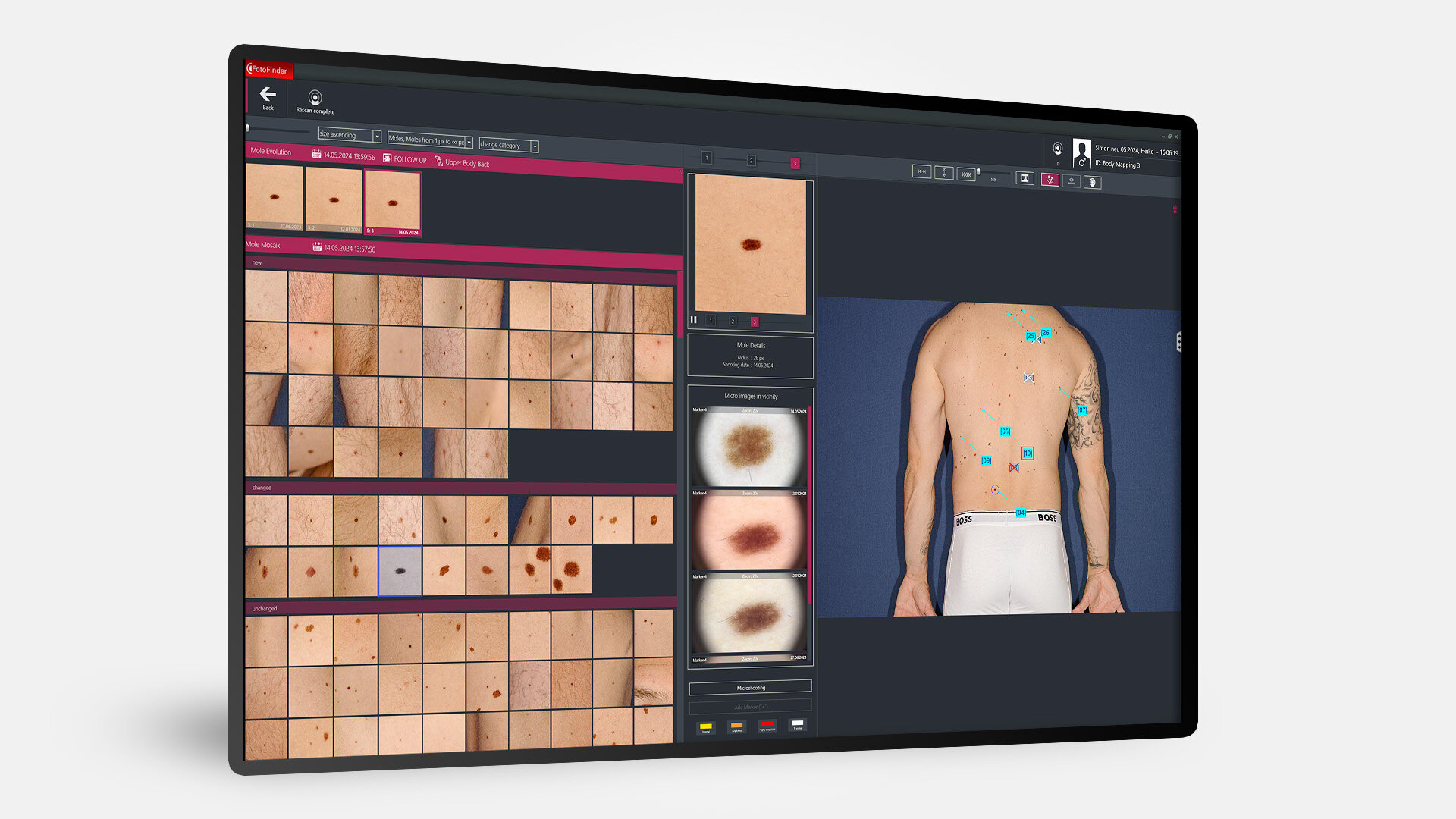 Bildschirm mit MosaikView