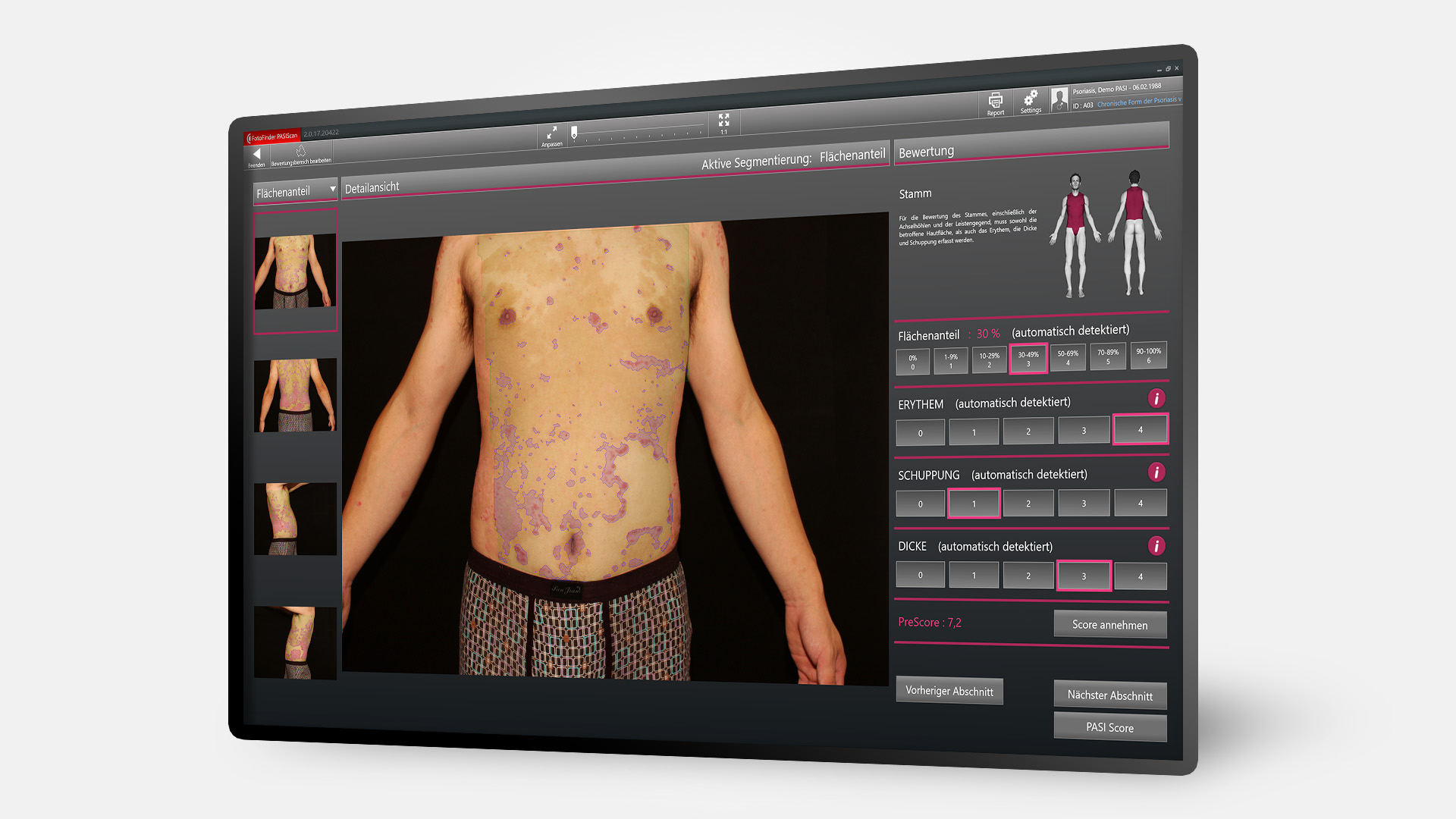 Bildschirm mit PASIScan