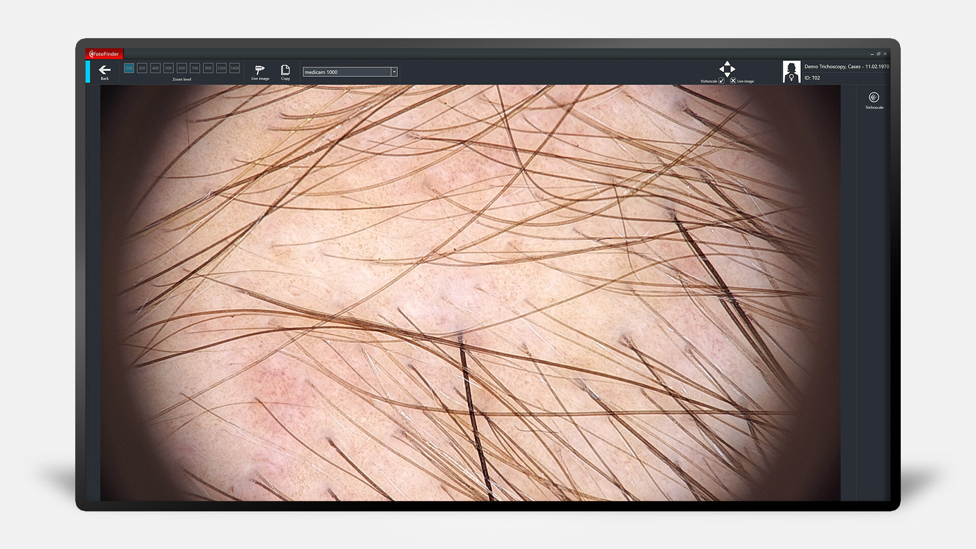 Bildschirm mit Trichoscale DX