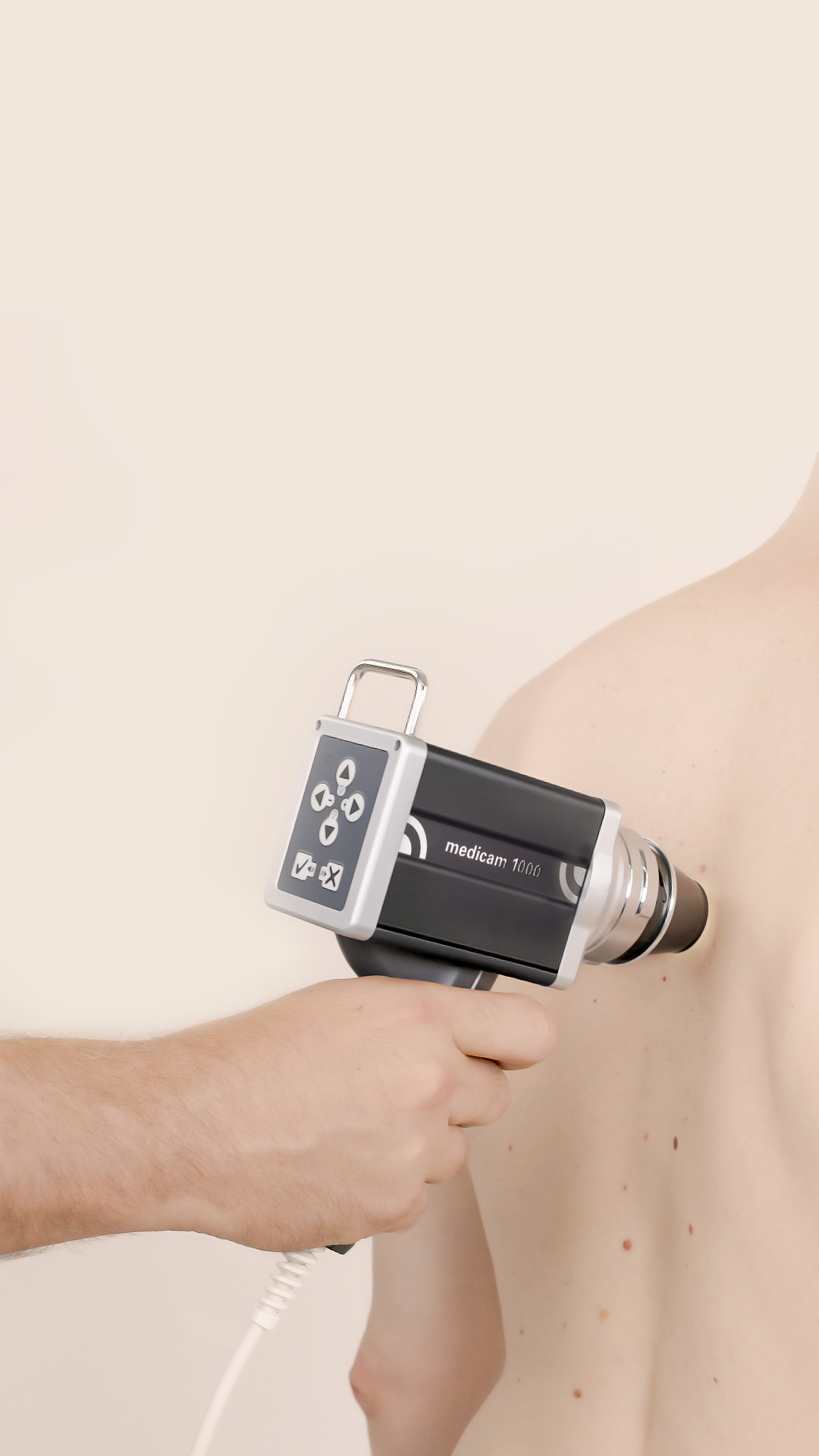 Video dermoscopy with the medicam 1000s on a patient’s upper body.