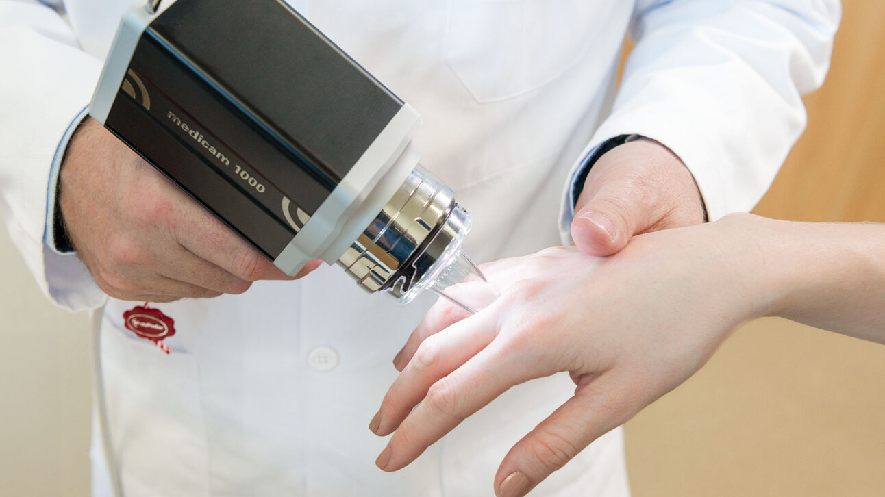 Dermatoskopische Untersuchung der Hand mit der FotoFinder medicam