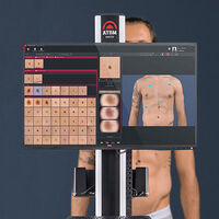 Total Body Dermoscopy