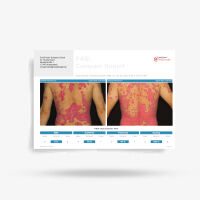  FotoFinder Systems PASIvision report 