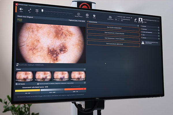Moleanalyzer pro / AI / Heatmap 