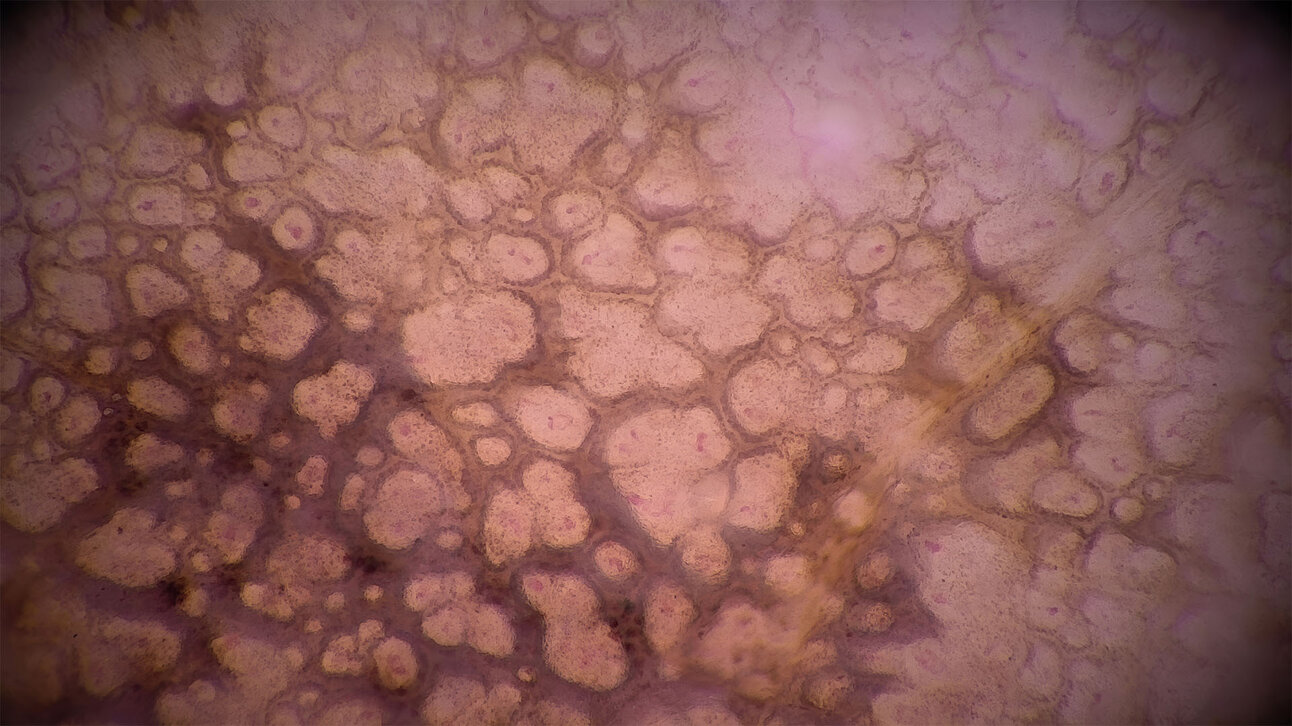 Dermatoskopisches Bild einer pigmentierten Hautstruktur in hoher Auflösung