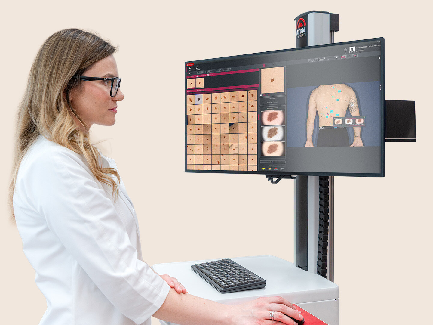 Doctor analyzing skin images on a digital dermoscopy system screen.