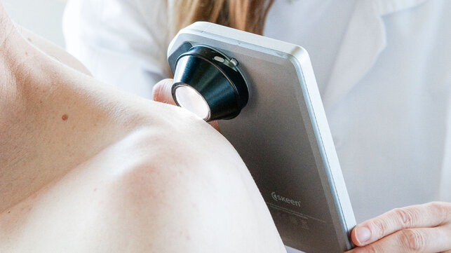 Nahaufnahme der Anwendung des skeen Geräts an der Schulter bzw. dem oberen Rücken