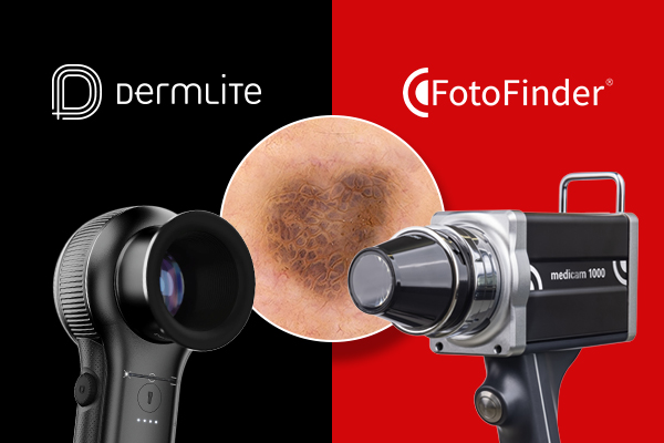 FotoFinder & DermLite