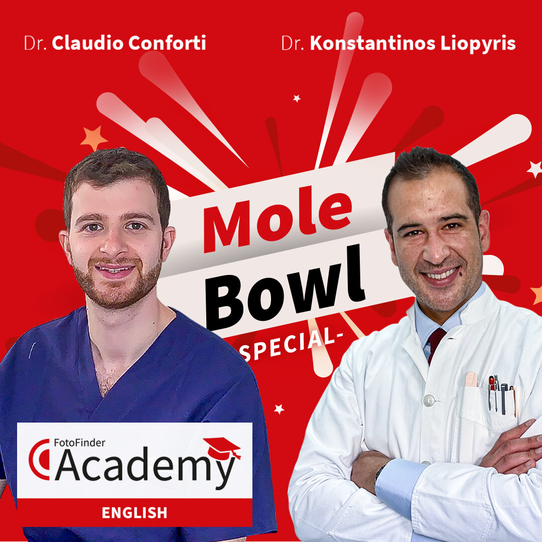 The 1st Dermoscopy Mole Bowl Special