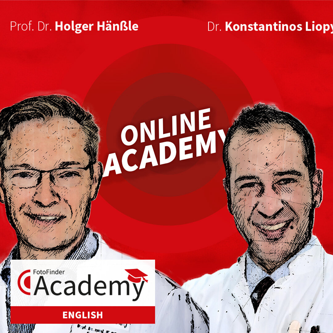 FotoFinder AI-SPECIAL - AI meets Total Body Dermoscopy