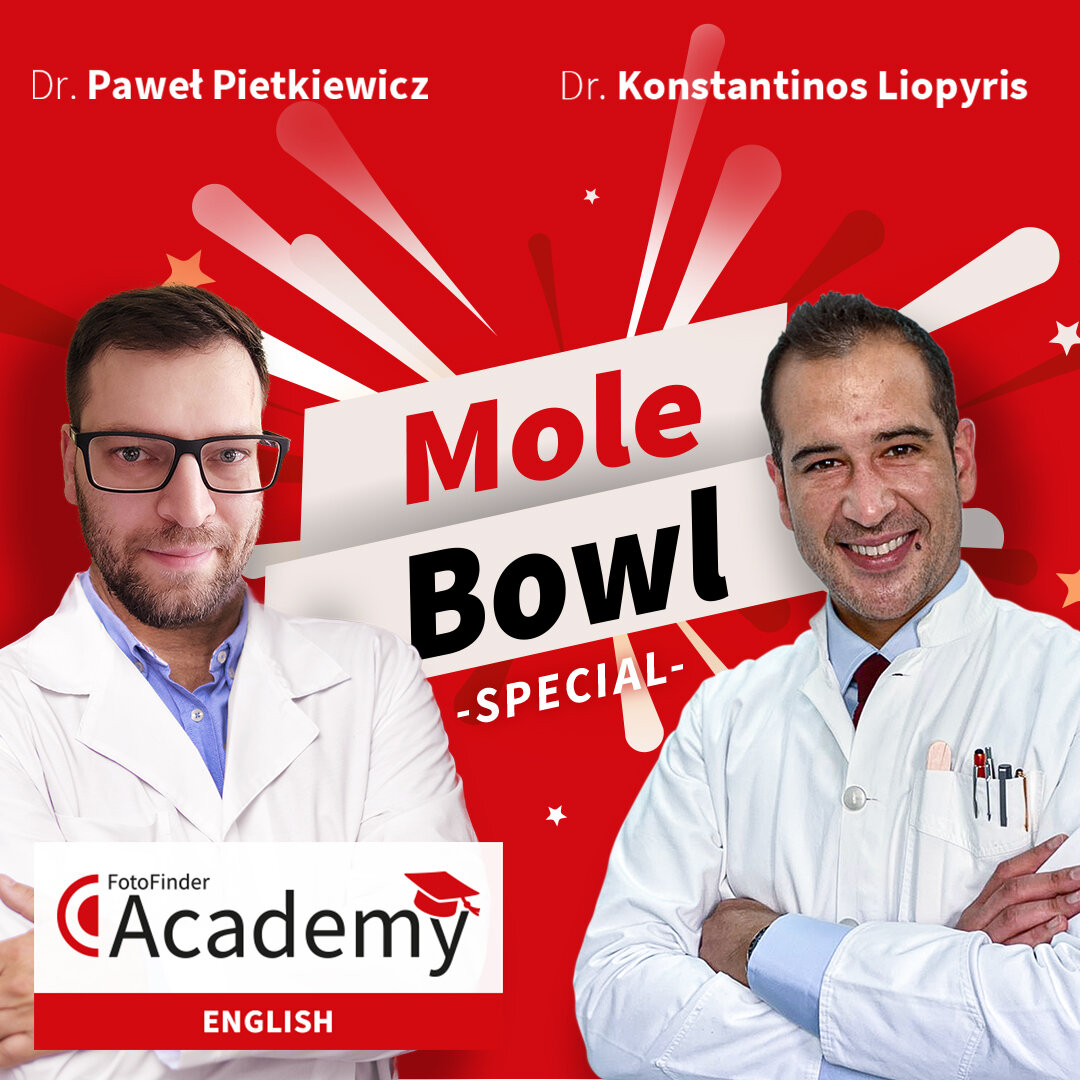 The Dermoscopy Mole Bowl - February Special