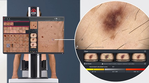 The ATBM master with Mosaik View and AI Scoring. 