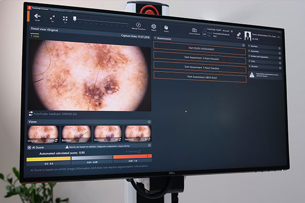 Moleanalyzer pro / AI / Heatmap 