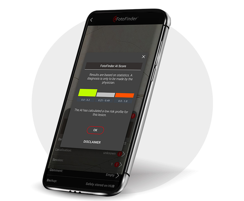 [Translate to English:] FotoFinder Systems, FotoFinder AI, Handyscope pro, Analyse und Segmentierung