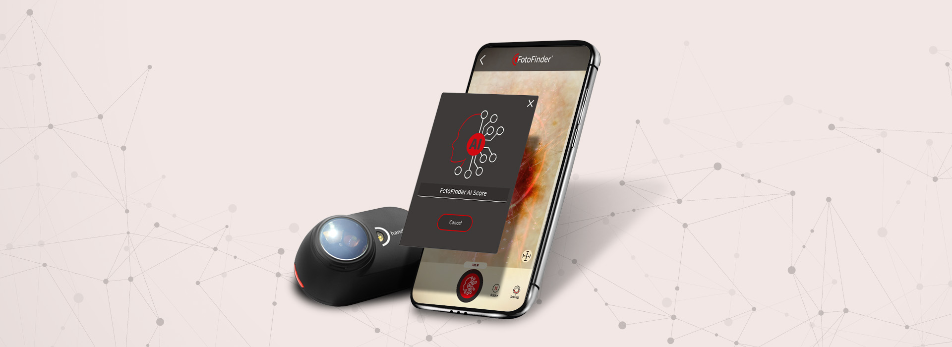 [Translate to English:] FotoFinder Systems, FotoFinder AI, handyscope pro App AI