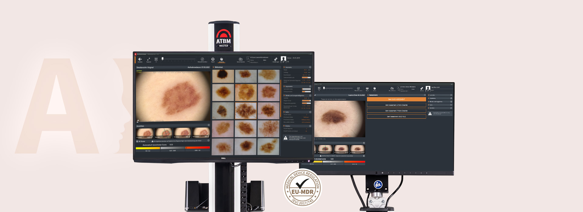FotoFinder Systems, FotoFinder AI, Moleanalyzer pro