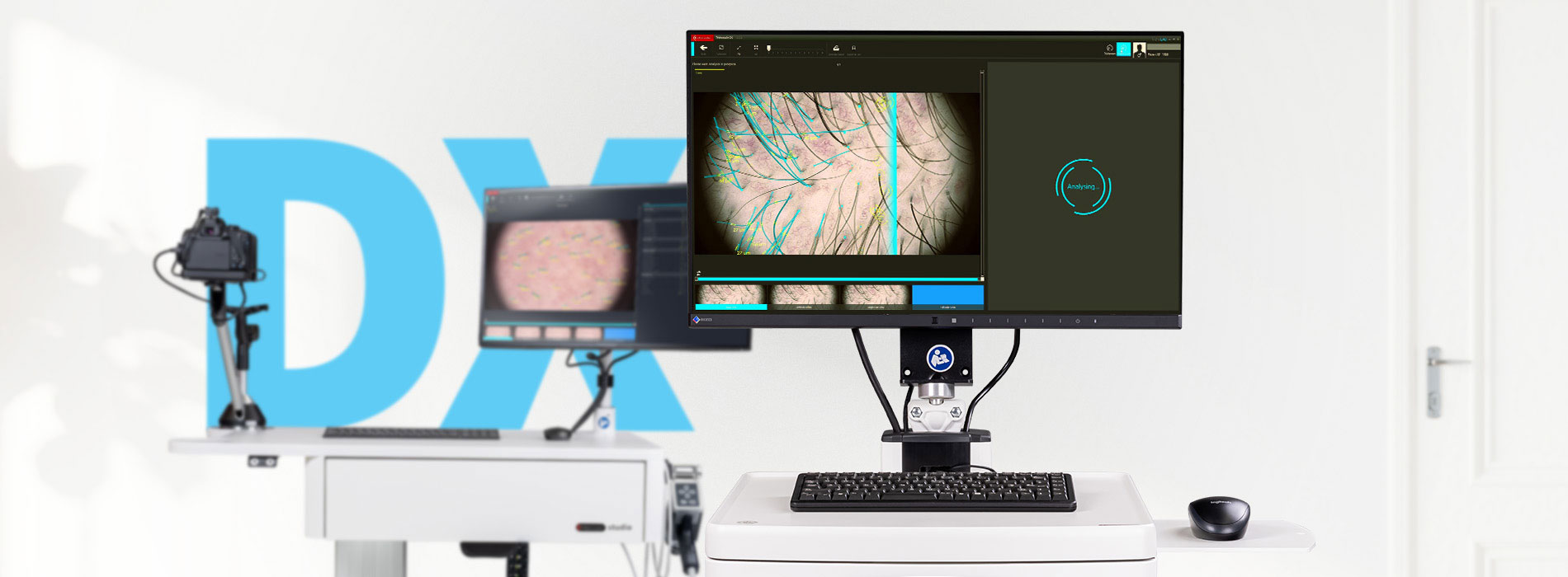 FotoFinder Systems, Trichoscale DX, TrichoLAB