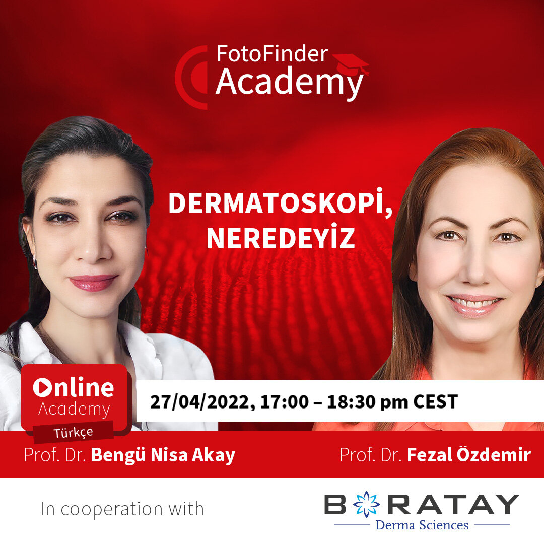 Turkey Edition DERMATOSKOPİ, NEREDEYİZ