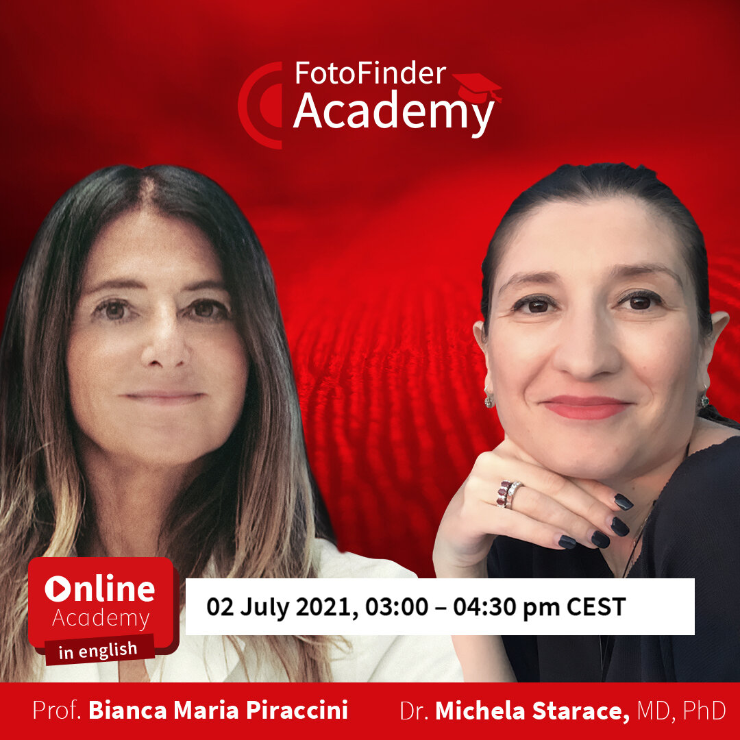 The Bolognese Recipe for Nail Dermoscopy