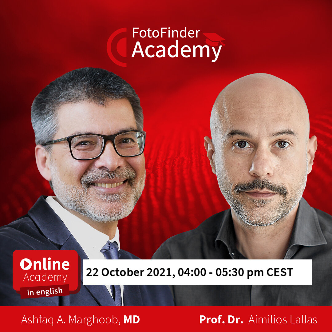 Dermoscopoetry - The art of diagnosis or overdiagnosis of melanoma