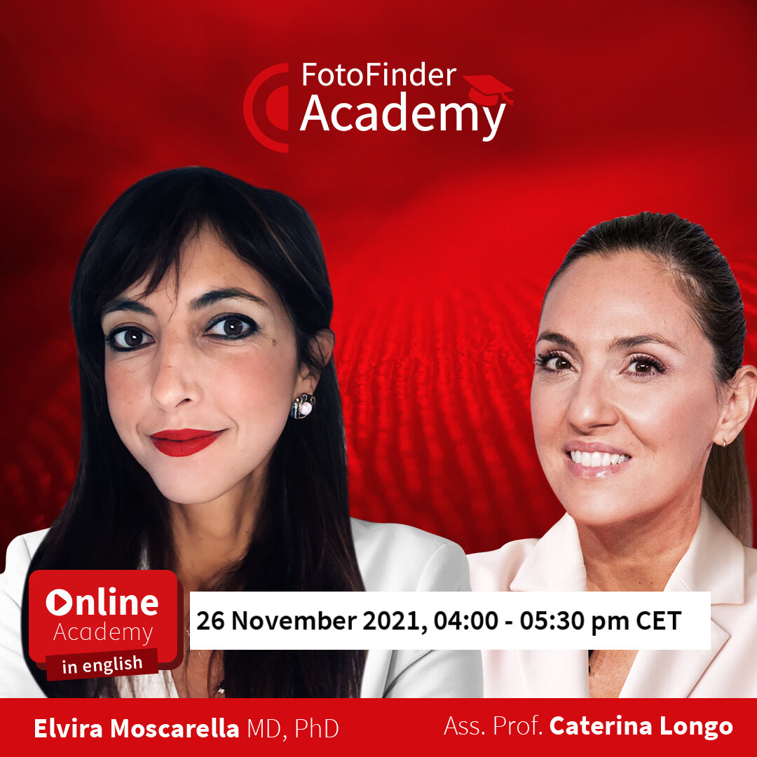 Dermoscopy all life long: Common and uncommon scenarios in children and elderly