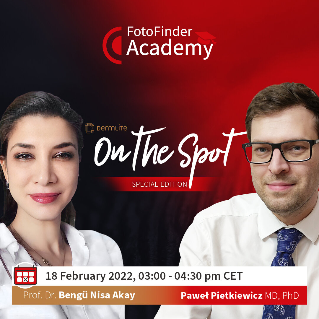 DermLite On the Spot Special Edition